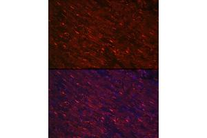 Immunofluorescence analysis of rat heart using PG Rabbit pAb (ABIN6132481, ABIN6145500, ABIN6145501 and ABIN6223912) at dilution of 1:100 (40x lens). (PGAM2 antibody  (AA 1-253))