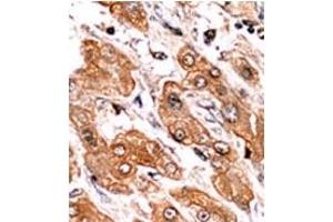 Image no. 2 for anti-BCL2-Interacting Killer (Apoptosis-Inducing) (BIK) (pThr33) antibody (ABIN358090)