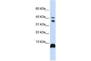 WB Suggested Anti-HMGN1 Antibody Titration:  0. (HMGN1 antibody  (Middle Region))