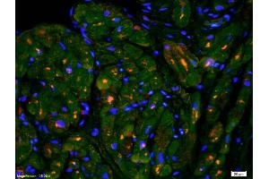 Formalin-fixed and paraffin-embedded rat cardiac muscle labeled with Anti-M Cadherin Polyclonal Antibody, Unconjugated (ABIN719831) 1:200, overnight at 4°C, The secondary antibody was Goat Anti-Rabbit IgG, Cy3 conjugated used at 1:200 dilution for 40 minutes at 37°C. (CDH15 antibody  (AA 355-450))