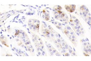 Immunohistochemistry (IHC) image for anti-Chromogranin A (CHGA) (AA 24-154) antibody (ABIN7443716)