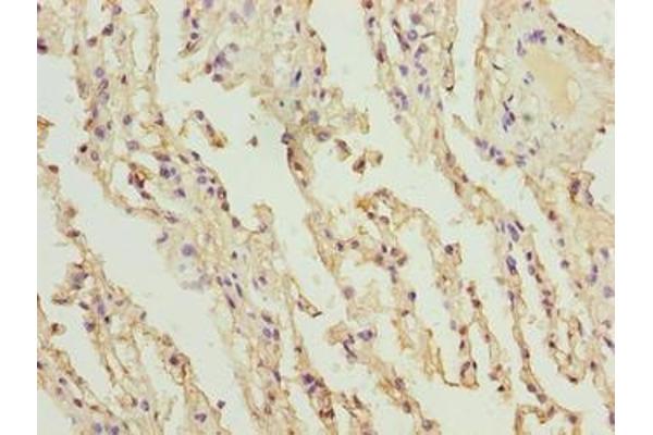 COL12A1 antibody  (AA 140-316)
