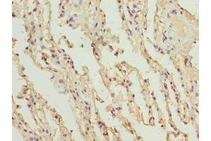 Immunohistochemistry of paraffin-embedded human lung tissue using ABIN7148227 at dilution of 1:100 (COL12A1 antibody  (AA 140-316))
