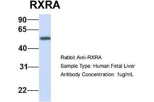 Host:  Rabbit  Target Name:  RXRA  Sample Type:  Human Fetal Liver  Antibody Dilution:  1. (Retinoid X Receptor alpha antibody  (N-Term))