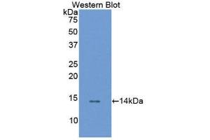 Western Blotting (WB) image for anti-Follicle Stimulating Hormone Receptor (FSHR) antibody (Biotin) (ABIN1175883) (FSHR antibody  (Biotin))