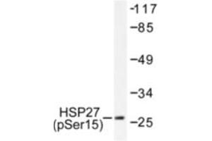 Image no. 1 for anti-Heat Shock 27kDa Protein 1 (HSPB1) (pSer15) antibody (ABIN318042) (HSP27 antibody  (pSer15))