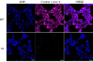 Immunocytochemical staining of HeLa cells using Creatine kinase B antibody (ABIN7798162), 1:1,000), Top panel: wild-type (WT), Bottom panal: Creatine kinase B shRNA knockdown (KD).