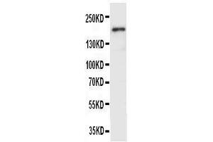 Anti-VEGF Receptor 2 antibody, Western blotting WB: SMMC Cell Lysate (VEGFR2/CD309 antibody  (Middle Region))