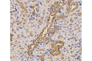 Immunohistochemistry of paraffin-embedded Rat kidney using KLK5 Polyclonal Antibody at dilution of 1:200 (40x lens). (Kallikrein 5 antibody)