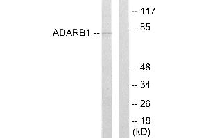Western blot analysis of extracts from HepG2 cells, using ADARB1 antibody. (RED1 antibody)
