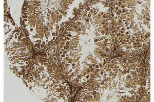 ABIN6277667 at 1/100 staining Mouse testis tissue by IHC-P.