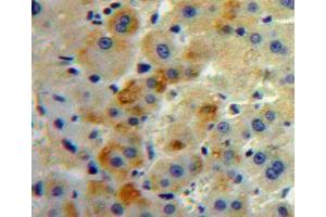 IHC-P analysis of Liver tissue, with DAB staining. (SLC30A8 antibody  (AA 263-369))
