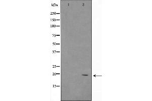 Western blot analysis of ASH2 using 293 whole cell lysates (ASH2L antibody  (Internal Region))