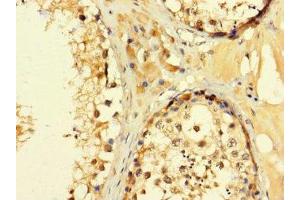 Immunohistochemistry of paraffin-embedded human testis tissue using ABIN7152994 at dilution of 1:100 (C2ORF83 antibody  (AA 29-150))