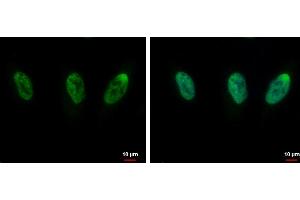 ICC/IF Image CIP29 antibody [N1C3] detects CIP29 protein at nucleus by immunofluorescent analysis. (SARNP antibody)