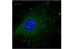 Immunofluorescence — anti-Rab5b Ab using B6-RPE07 cells at 1/100 dilutlon;