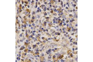 Immunohistochemistry (IHC) image for anti-ATP-Binding Cassette, Sub-Family A (ABC1), Member 6 (ABCA6) antibody (ABIN1870712) (ABCA6 antibody)