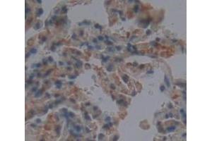 IHC-P analysis of Human Tissue, with DAB staining. (CLEC3B antibody  (AA 22-202))