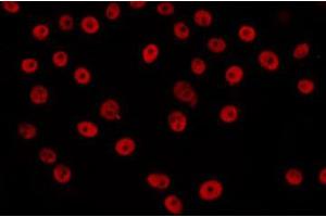 ABIN6266650 staining LOVO by IF/ICC. (HAT1 antibody  (C-Term))