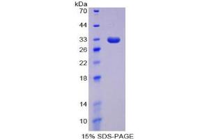 SDS-PAGE analysis of Human DNMT1 Protein.