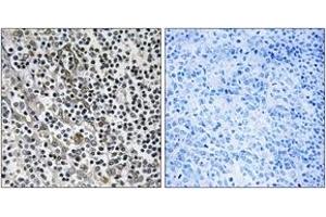 Immunohistochemistry analysis of paraffin-embedded human tonsil tissue, using MRPL51 Antibody. (MRPL51 antibody  (AA 51-100))