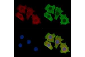 ABIN7095688 and ABIN7099750 staining HepG2 cells by IF/ICC.
