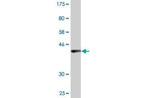 Western Blot detection against Immunogen (36. (UVRAG antibody  (AA 601-699))