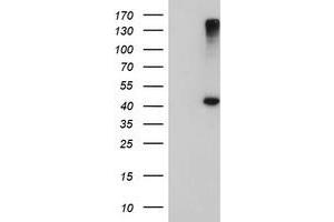 HEK293T cells were transfected with the pCMV6-ENTRY control (Left lane) or pCMV6-ENTRY AGPAT5 (Right lane) cDNA for 48 hrs and lysed. (AGPAT5 antibody)