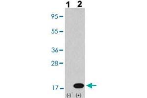 Western blot analysis of Lane 1: Nontransfected 293 cell lysates (2 ug/lane), Lane 2: Transiently transfected 293 cell lysates (2 ug/lane) with MAP1LC3B polyclonal antibody  at 1:1000 dilution.
