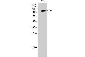 Western Blotting (WB) image for anti-ATR Interacting Protein (ATRIP) (Tyr783) antibody (ABIN3183447) (ATRIP antibody  (Tyr783))