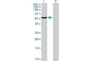Western Blot analysis of CYP4B1 expression in transfected 293T cell line by CYP4B1 MaxPab polyclonal antibody.