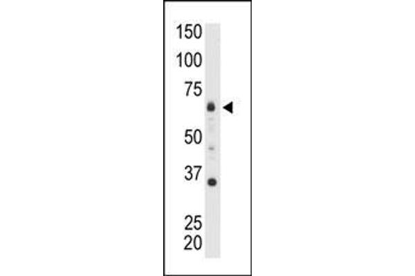 MTMR9 antibody  (C-Term)