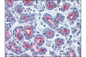 Immunohistochemistry (IHC) image for anti-Mucin 1 (MUC1) (C-Term) antibody (ABIN371859) (MUC1 antibody  (C-Term))