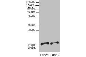 Western blot All lanes: PFDN5 antibody at 2 μg/mL Lane 1: EC109 whole cell lysate Lane 2: 293T whole cell lysate Secondary Goat polyclonal to rabbit IgG at 1/15000 dilution Predicted band size: 18, 8, 13 kDa Observed band size: 18 kDa (PFDN5 antibody  (AA 2-154))