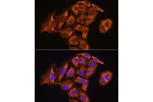 Immunofluorescence analysis of U2OS cells using Thioredoxin reductase 2 (TXNRD2 ) antibody (ABIN6128856, ABIN6149741, ABIN6149742 and ABIN6221158) at dilution of 1:100. (TXNRD2 antibody  (AA 100-310))