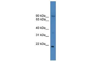 WB Suggested Anti-FOXM1 Antibody Titration:  1 ug/ml  Positive Control:  THP-1 cell lysate (FOXM1 antibody  (N-Term))