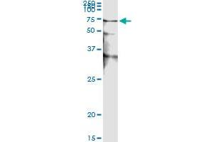Immunoprecipitation (IP) image for anti-serine/threonine Kinase 38 (STK38) (AA 1-466) antibody (ABIN599179) (STK38 antibody  (AA 1-466))