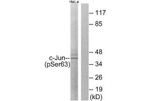 Western Blotting (WB) image for anti-Jun Proto-Oncogene (JUN) (pSer63) antibody (ABIN1847457) (C-JUN antibody  (pSer63))