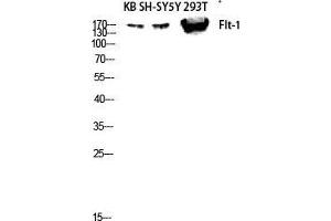 Western Blot (WB) analysis of KB SH-SY5Y 293T lysis using Flt-1 antibody. (FLT1 antibody  (Ser385))