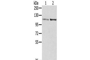 Western Blot analysis of A172 and 231 cells using SENP7 Polyclonal Antibody at dilution of 1/800 (SENP7 antibody)
