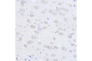 Immunohistochemistry of paraffin-embedded rat brain using UBE4A Rabbit pAb (ABIN6128897, ABIN6149841, ABIN6149842 and ABIN6220229) at dilution of 1:100 (40x lens). (UBE4A antibody  (AA 797-1066))