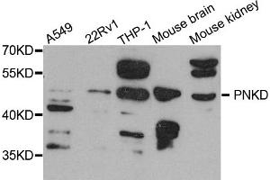 Western blot analysis of extracts of various cell lines, using PNKD antibody. (PNKD antibody)