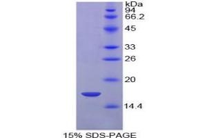 SDS-PAGE analysis of Chicken HIF1a Protein. (HIF1A Protein)