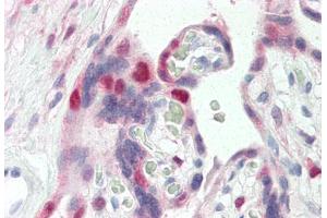 Human Placenta (formalin-fixed, paraffin-embedded) stained with CDK2 antibody ABIN337208 at 5 ug/ml followed by biotinylated anti-mouse IgG secondary antibody ABIN481714, alkaline phosphatase-streptavidin and chromogen. (CDK2 antibody)