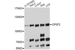 Western blot analysis of extracts of various cell lines, using CPSF2 antibody. (CPSF2 antibody)