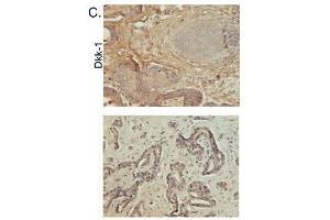 Image kindly submitted by Dr. (DKK1 antibody  (AA 201-266))