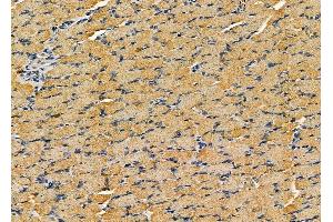 ABIN6260967 and ABIN6279315 at 1/100 staining rat muscle tissue by IHC-P. (COPG antibody  (C-Term))