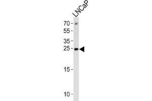 Western Blotting (WB) image for anti-Tumor Protein, Translationally-Controlled 1 (TPT1) antibody (ABIN3003778) (TPT1 antibody)
