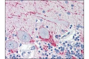 Immunohistochemistry (IHC) image for anti-Vesicle-Associated Membrane Protein 2 (Synaptobrevin 2) (VAMP2) (AA 1-89), (N-Term) antibody (ABIN317061) (VAMP2 antibody  (N-Term))