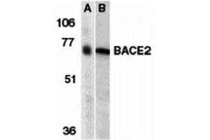 Western Blotting (WB) image for anti-beta-Site APP-Cleaving Enzyme 2 (BACE2) (N-Term) antibody (ABIN1031256) (BACE2 antibody  (N-Term))